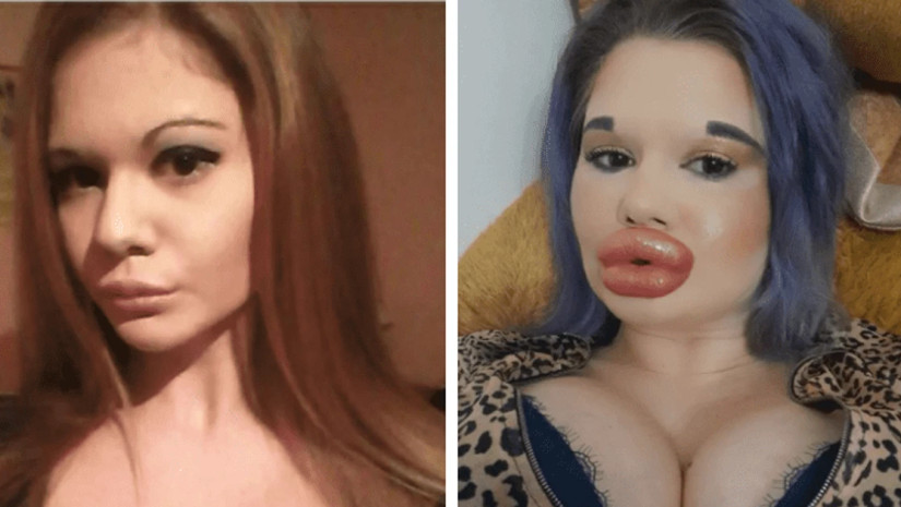 ფილერი