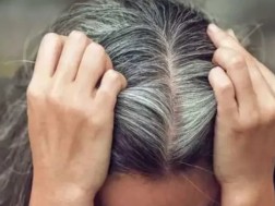 Which mineral might you be deficient in if you develop gray hair?