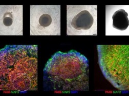 ადამიანის ტვინის ქსოვილისგან ფუნქციური კომპიუტერი შექმნეს