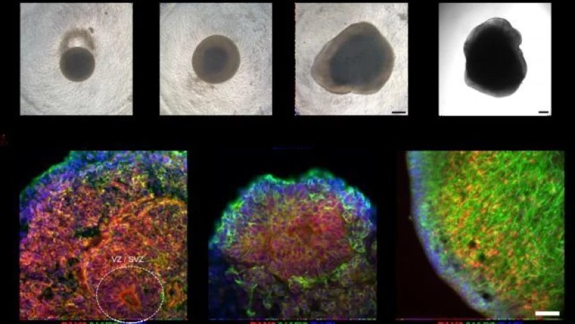 ადამიანის ტვინის ქსოვილისგან ფუნქციური კომპიუტერი შექმნეს