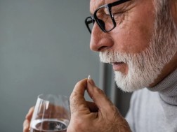 ალცჰაიმერი