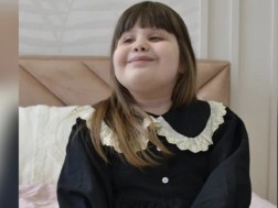 7-year-old Elene Viblian needs the public's help - she needs surgery on both legs