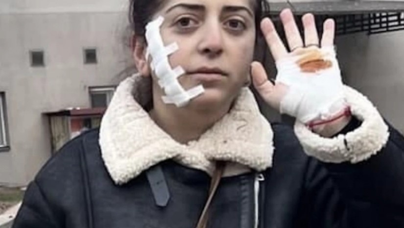   ფიქრია ეპიტაშვილი
