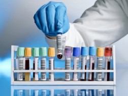 What analysis should you do if you think you have aflatoxin -containing products?
