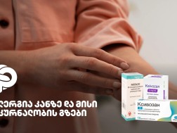 ალერგია