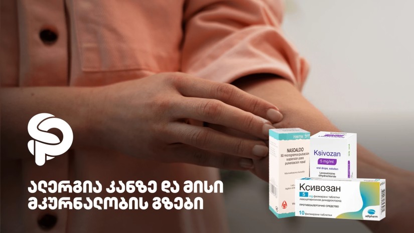 ალერგია ალერგია