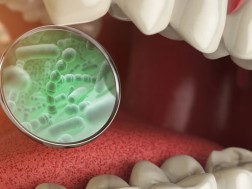 Scientists say one of the most deadly tumors may be in our mouths