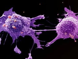 სად ქრება კიბოს უჯრედები სად ქრება კიბოს უჯრედები