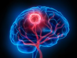 თავის ტვინი