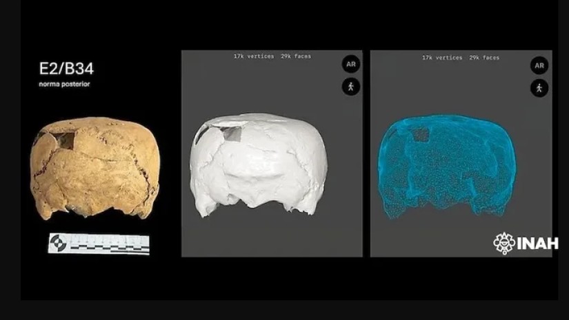 ოთხკუთხა ფორმის თავის ქალა
