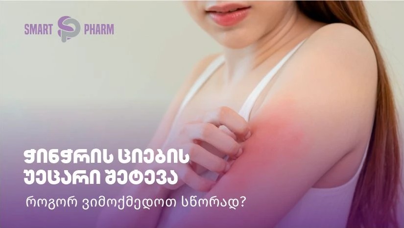 ჭინჭრის ციების უეცარი შეტევა – როგორ ვიმოქმედოთ სწორად?