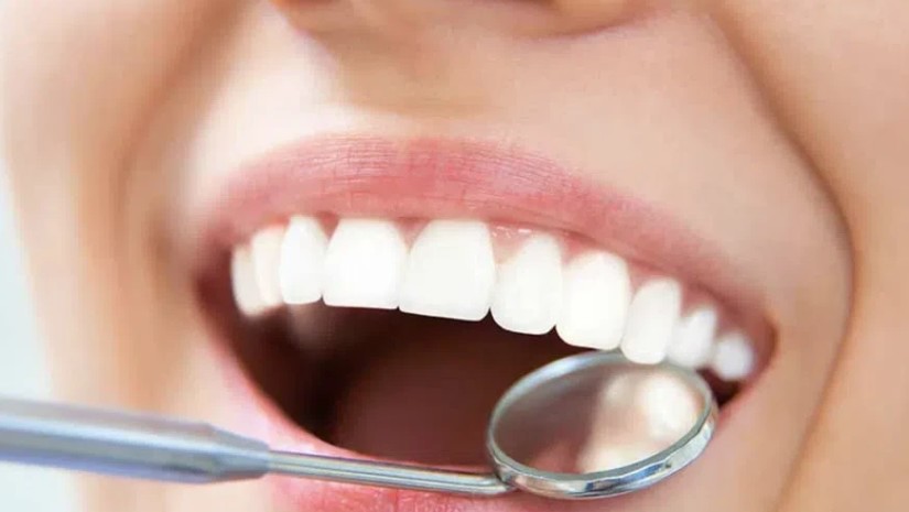 კბილები