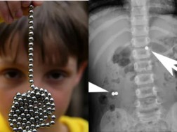 ექიმების საგანგაშო გაფრთხილება