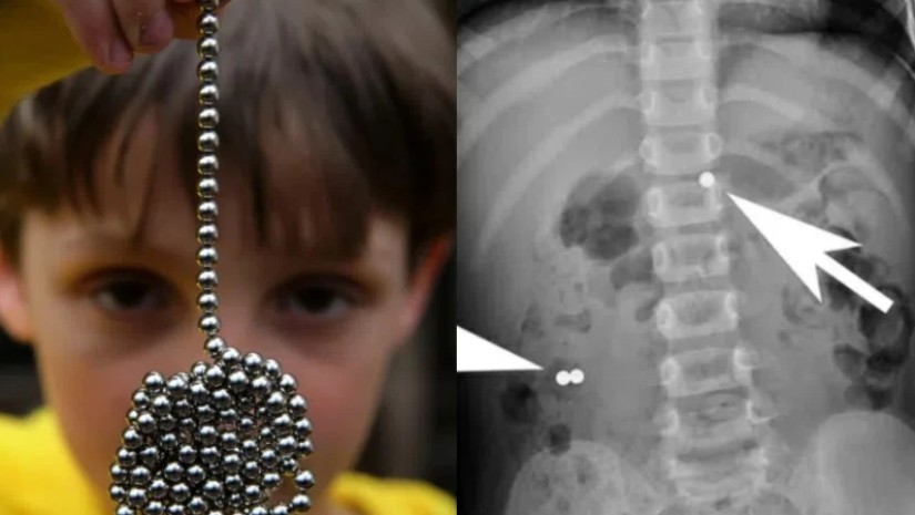 ექიმების საგანგაშო გაფრთხილება