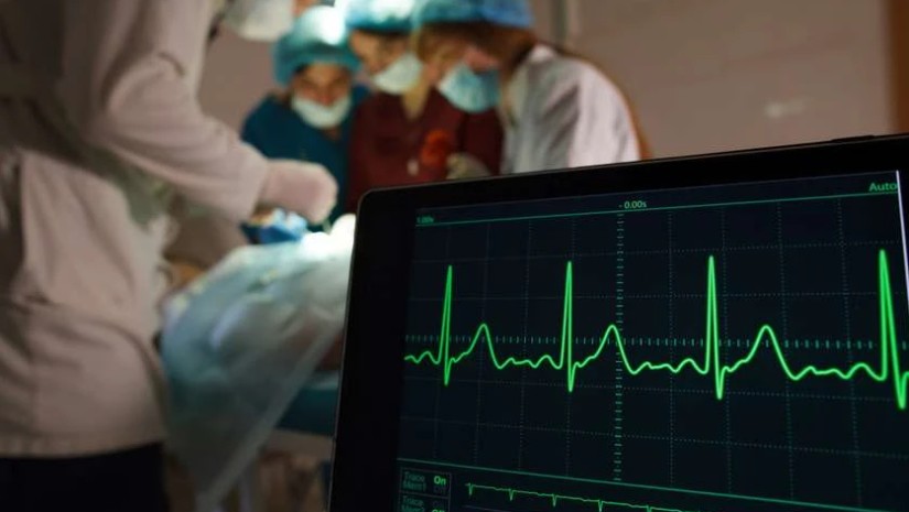 ოპერაცია