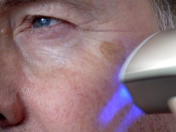 გაახალგაზრდავება