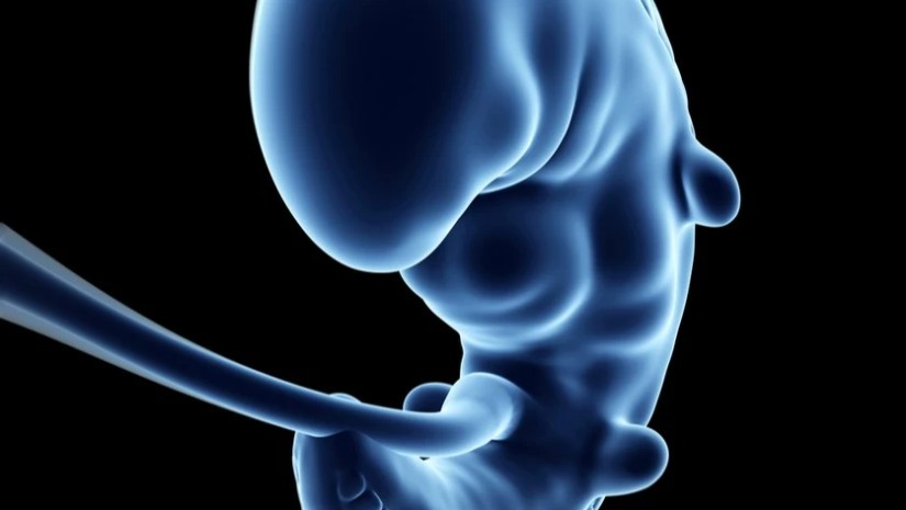 დაავადება