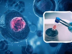 ღეროვანი უჯრედი