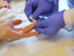 სკრინინგი