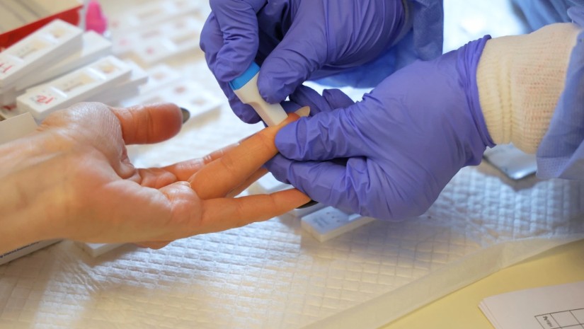 სკრინინგი