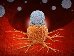 პროსტატის კიბო