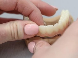 პროთეზი