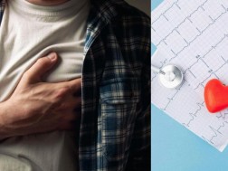 გულის შეტევა