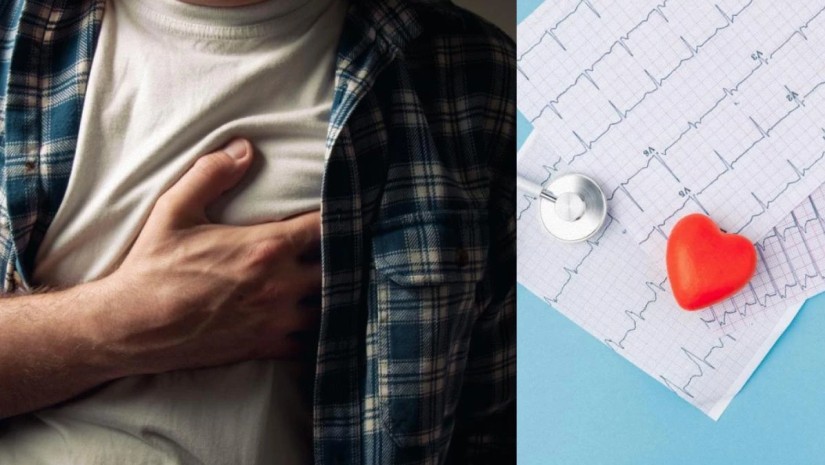 გულის შეტევა